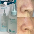 올영세일추천템 일소 피지클리너 어워즈 기획 사용후기