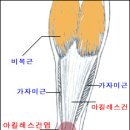 Achilles힘줄 = Fuse(퓨~즈) 이미지