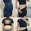 우주사 | 강남 복부지방분해주사 vs 복부지방흡입 차이 비교 시술 후기