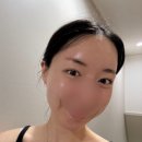 건성(주) | 무통 리쥬란 후기｜건성피부 스킨부스터 1년만에 다시 받은 이유