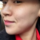 보라사진실 | (찐후기) 30대 여자 시술 추천 / 여배우 리프팅 / 피부관리 / 티타늄 리프팅 / 제네오 엑스 / 효과...