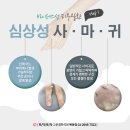 목동인의한의원 | 목동,신월동 사마귀 치료 하는 곳:바이러스성피부질환