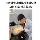 초2 아랫니 삐뚤게 올라와 걱정돼 다녀온 강남 임플라인치과 소아교정 상담 후기