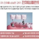에스프라임 이미지