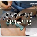 아미규네일