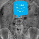 UR(의정부시)-[시민로]-상-38 | 동두천 요로결석 24시 - 요관 돌로 인해 열이 나기 전에 가능한 빨리 치료 받아야 합니다.