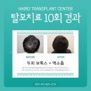 정직한마음약국 | 화성탈모성지 예약 처방 이식 실패없는 공식