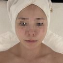 월암로 | 대구 | 신부관리 온다리프팅 잘하는 곳 ‘하울뷰티’, 솔직후기