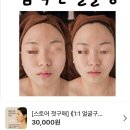 [바른얼굴윤곽연구소] 얼굴골격축소 1년 프로젝트 1회차 뒤늦은 기록!ㅠㅠ