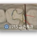 파란치과기공소 이미지