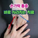 손가락 통증 바로 사라지는 운동법 이미지