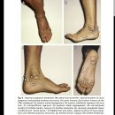 등업부탁합니다 Ankle pain landmark 입니다 이미지