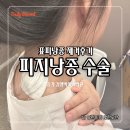 김앤박차이의원 | 피지낭종 제거 - 종로/광화문 표피낭종 제거 병원 비용 및 후기 (방치하지말고 빠르게 제거하세요...!)