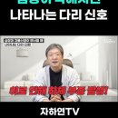 심장이 약해지면 나타나는 다리 신호 이로 인해 하체 부종 발생 이미지