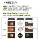 마곡드림빛안과의원 이미지