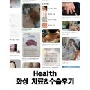 죽이야기 한강성심병원점 | 화상전문병원 영등포 한강성심병원 화상치료 수술후기