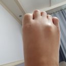 발등 혹 아시는분이요 이미지