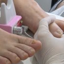 닥터아이티엔네일앤풋솔루션 | [ 경산 무좀발톱 케어 ] 경산 치유네일 내성발톱, 문제성발톱 관리 추천 후기!