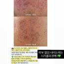 코씨 17차 공구 오픈 🤍 2년 꾸준히 쓴 이유 + 피부 변화 후기 (콜라겐,광채,시카,비타라인)