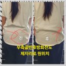 용인 기흥피부관리 리저브미에서 JH윤곽술 받은 후기