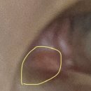 서울새봄안과의원 이미지