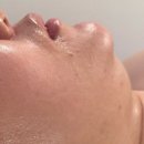 4471 | 두정동리프팅 에버림 싸이블로 피부관리 만족후기