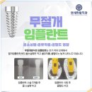 (의)미래의료재단미래치과의원 | [무절개 임플란트 후기] 안정적으로 수술 가능하고 오래 사용할 수 있는 임플란트는?