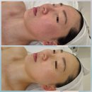 대구남산초등학교 | 대구 중구 남산동 피부관리 추천ㅣ예비신부 수기윤곽테라피 후기ㅣ로아에스테틱