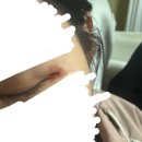 영광(아) | 창원 천주산 진달래 그리고 얻은 영광의 상처
