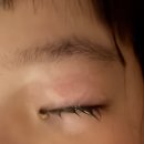 안약사의 안약국 | 유아 알레르기성 결막염 증상과 처방 안약 4종 상세후기