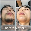 아나덴 슈가링 왁싱 마곡역점 이미지