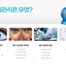 스마일슈퍼(등3) | 스마일라식 비용 수술 전 검사 내돈내산 후기!