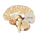 안면인식장애[Prosopagnosia뇌신경정신질환] 이미지