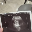 복인 민박 | ​ [안심플 근황] 둘째, 서울 이사, 그리고 커리어 재정비를 앞두고