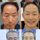 인셀덤블랙