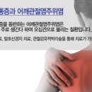 어깨통증의 증상에 따른 주요질환 이미지