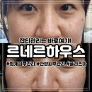 임광어린이집 | 잡티관리 단 한번으로 전후 차이 확실한 솔직 후기 범계피부관리 르네르하우스 안양범계점