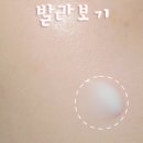 브이아이피테라피