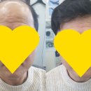 가발히트모