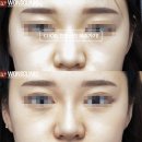 하이코코 이미지