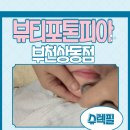 태평양뷰티주 | 상동 슈렉필관리로 여드름관리하는 뷰티포톤피아 피부개선에 도움되는 찐 케어