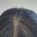 홀드의원 이미지