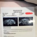중국 우한 산부인과 후기 (임신)