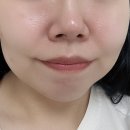 동탄 여드름 관리🧴 셀리올리 스킨랩 솔직후기