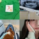 병영김치과의원 | 매복 사랑니 발치 광주 사랑니 전문 치과 “쏙쏙 사랑니 치과” 내돈내산 추천(통증,붓기,지혈)