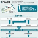 남성에서 환자수가 가장 많은 전립선암 PSA검사의 수치 어떻게 활용？ 이미지