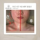 에스테틱 힐링수