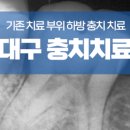 정평탑치과 네이버블로그