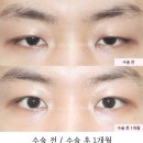 강남서연성형외과의원 이미지