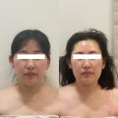 청주 강서동 웨딩관리 필수성지 ‘정담에스테틱’ 갸름샷 피부관리 후기